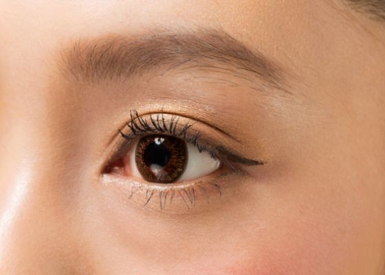 奈良県橿原市の眼瞼下垂の治療